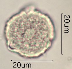 Scrub Oak (Quercus berberidifolia) Pollen under the Microscope