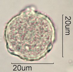Scrub Oak (Quercus berberidifolia) Pollen under the Microscope