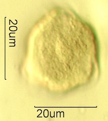 Scrub Oak (Quercus berberidifolia) Pollen under the Microscope