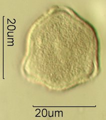 Scrub Oak (Quercus berberidifolia) Pollen under the Microscope