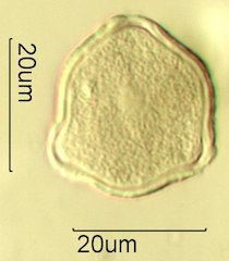 Scrub Oak (Quercus berberidifolia) Pollen under the Microscope