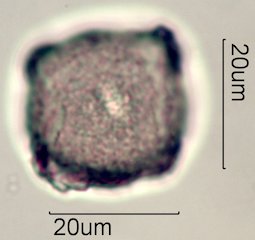 Scrub Oak (Quercus berberidifolia) Pollen under the Microscope