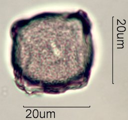 Scrub Oak (Quercus berberidifolia) Pollen under the Microscope
