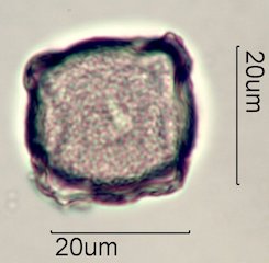 Scrub Oak (Quercus berberidifolia) Pollen under the Microscope