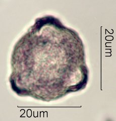 Scrub Oak (Quercus berberidifolia) Pollen under the Microscope