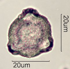 Scrub Oak (Quercus berberidifolia) Pollen under the Microscope