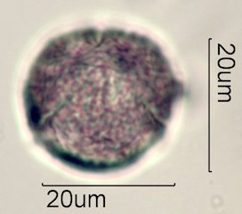 Scrub Oak (Quercus berberidifolia) Pollen under the Microscope
