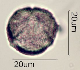 Scrub Oak (Quercus berberidifolia) Pollen under the Microscope