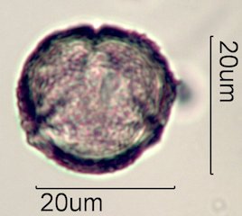 Scrub Oak (Quercus berberidifolia) Pollen under the Microscope