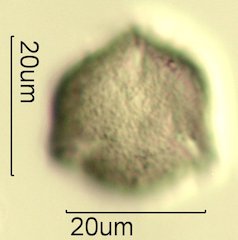 Scrub Oak (Quercus berberidifolia) Pollen under the Microscope
