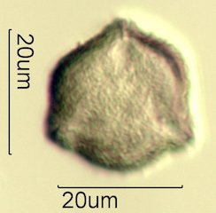 Scrub Oak (Quercus berberidifolia) Pollen under the Microscope