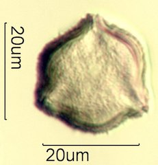 Scrub Oak (Quercus berberidifolia) Pollen under the Microscope