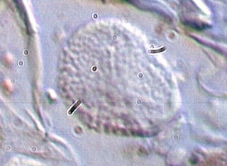 Odium Spores