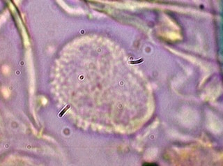 Odium Spores