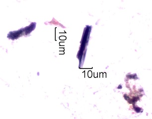 Black Particles in Homes Under the Microscope