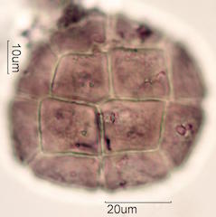 Acacia Pollen