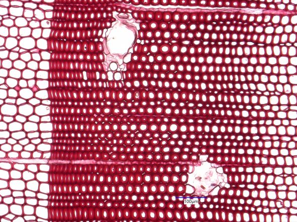 Pinus banksiana, Cross-Section