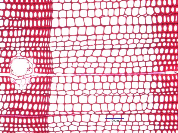Pinus resinosa, Cross-Section