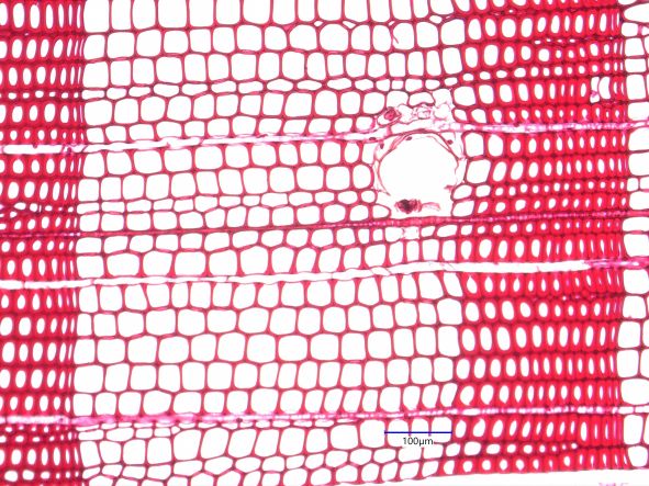 Pinus resinosa, Cross-Section