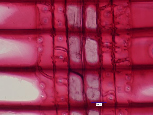 Pinus resinosa, Radial Section