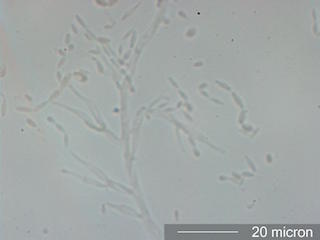 Paecylomyces Spores