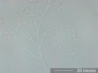 Paecylomyces Spores