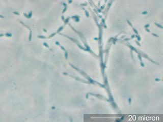 Paecylomyces Spores