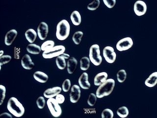Pea Starch Under the Microscope