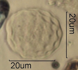 Periporate Pollen