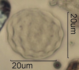 Periporate Pollen