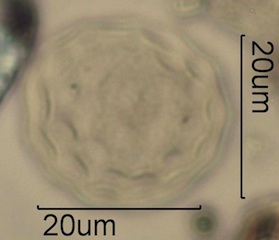Periporate Pollen