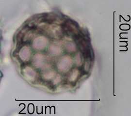 Periporate Pollen