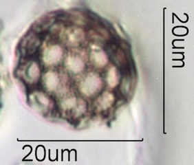 Periporate Pollen
