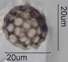Periporate Pollen
