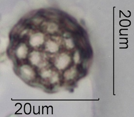 Periporate Pollen