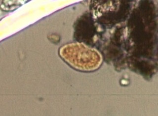Peronospora Spores