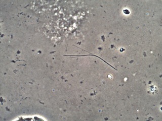 Cleared Filter Containing Amosite, Phase Contrast 40X Objective