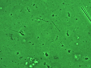 Cleared Filter Containing Amosite, Phase Contrast 40X Objective