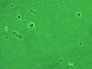 Cleared Filter Containing Chrysotile, Phase Contrast 40X Objective