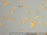 Phosphate by AgNO<sub>3</sub>