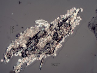 Calcium Oxalate Prisms in a Plant Fragment