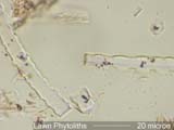 Phytolith from Lawn