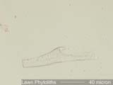Phytolith from Lawn