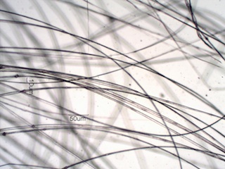 Band-Tailed Pigeon (Columbidae) Under the Microscope