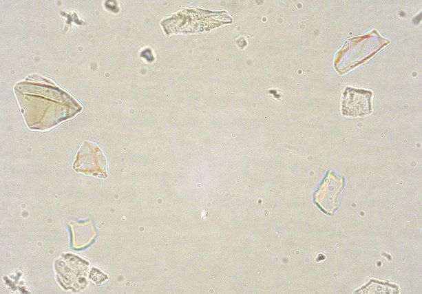 Dispersion Staining, Becke' Line