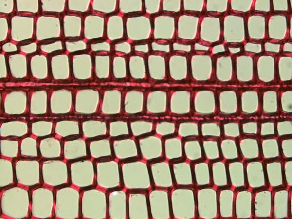 Pinus Ponderosa, Cross-Section