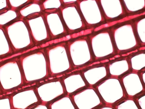 Pinus Ponderosa, Cross-Section