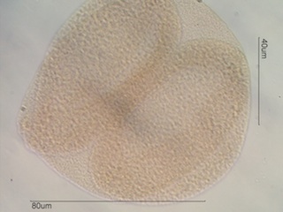 Whitebark Pine Pollen