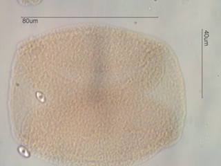 Whitebark Pine Pollen