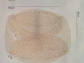 Whitebark Pine Pollen